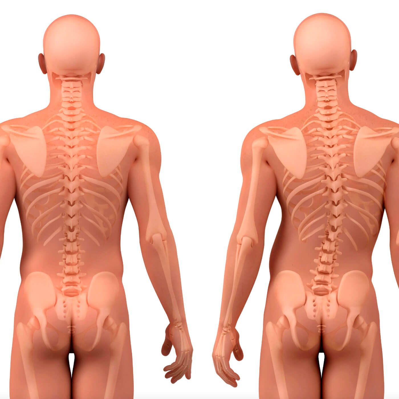 Essential Chiropractic and Healthcare Clinic- Chiropractic Conditions Scoliosis Treatment Melbourne Northern Suburbs