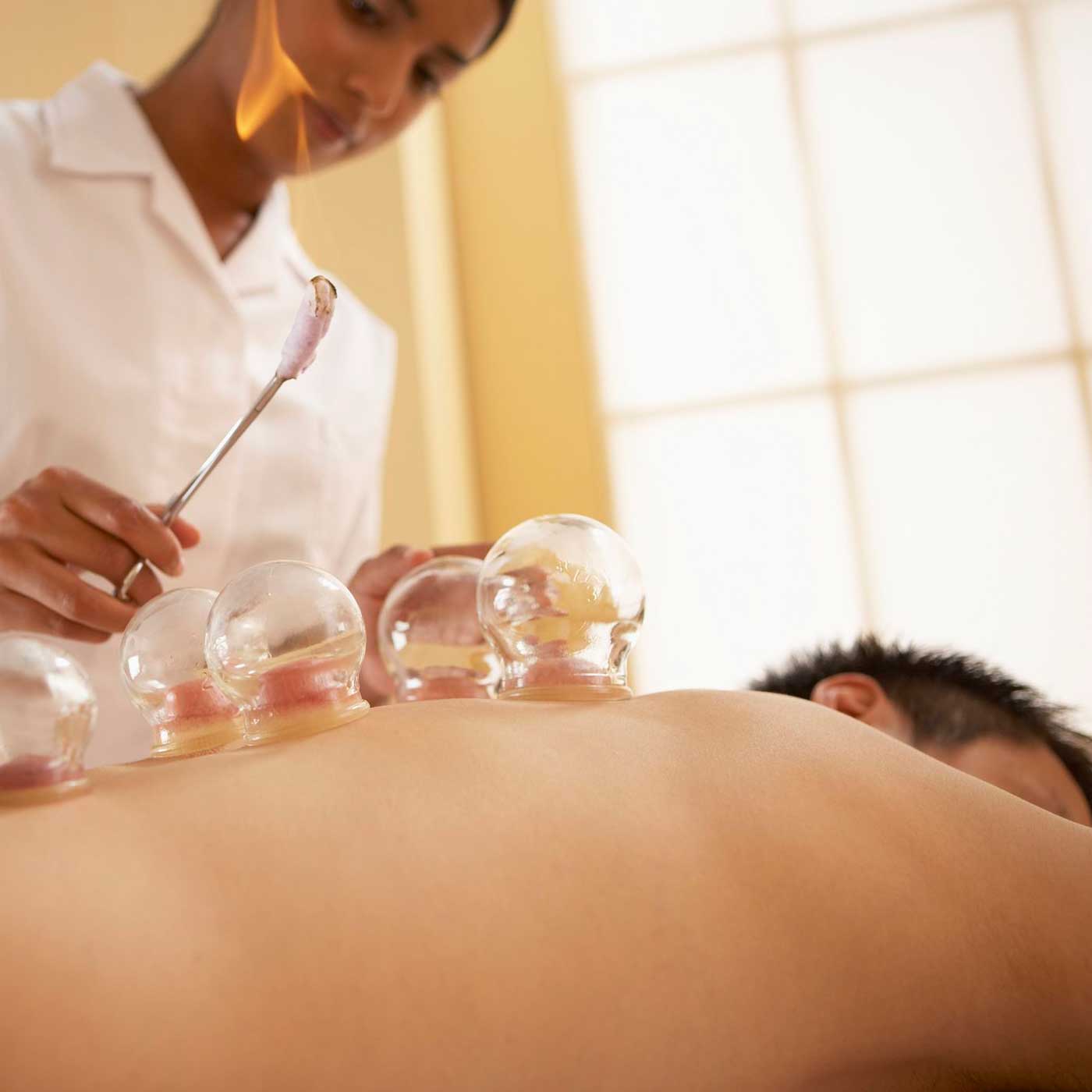 Essential Chiropractic and Healthcare Clinic - Massage Types Remedial Massage Back Cupping