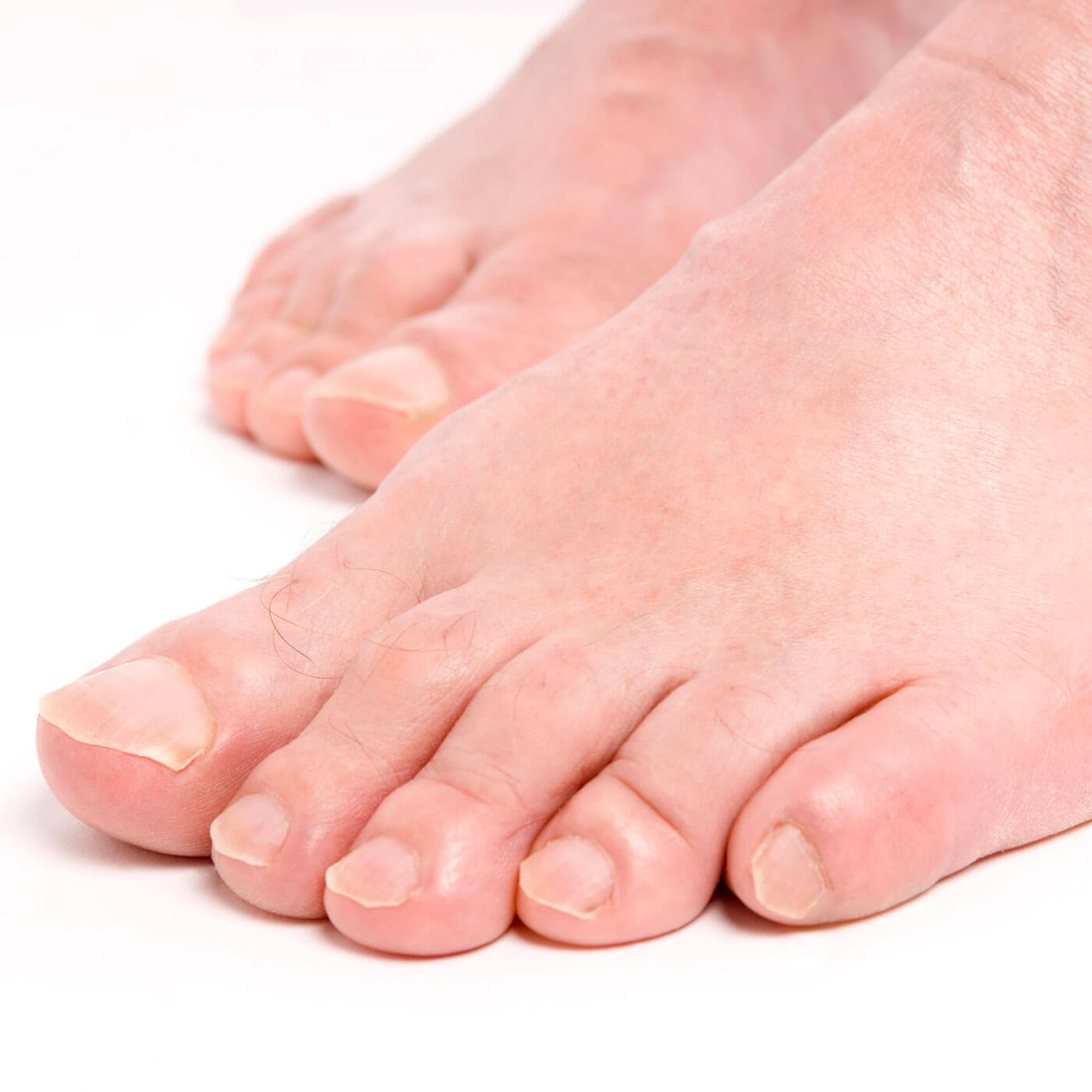 Essential Chiropractic and Healthcare Clinic - Podiatry treatment for Plantar Warts