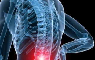 Essential Chiropractic and Healthcare Clinic - Sciatica Back Pain Relief and Treatment